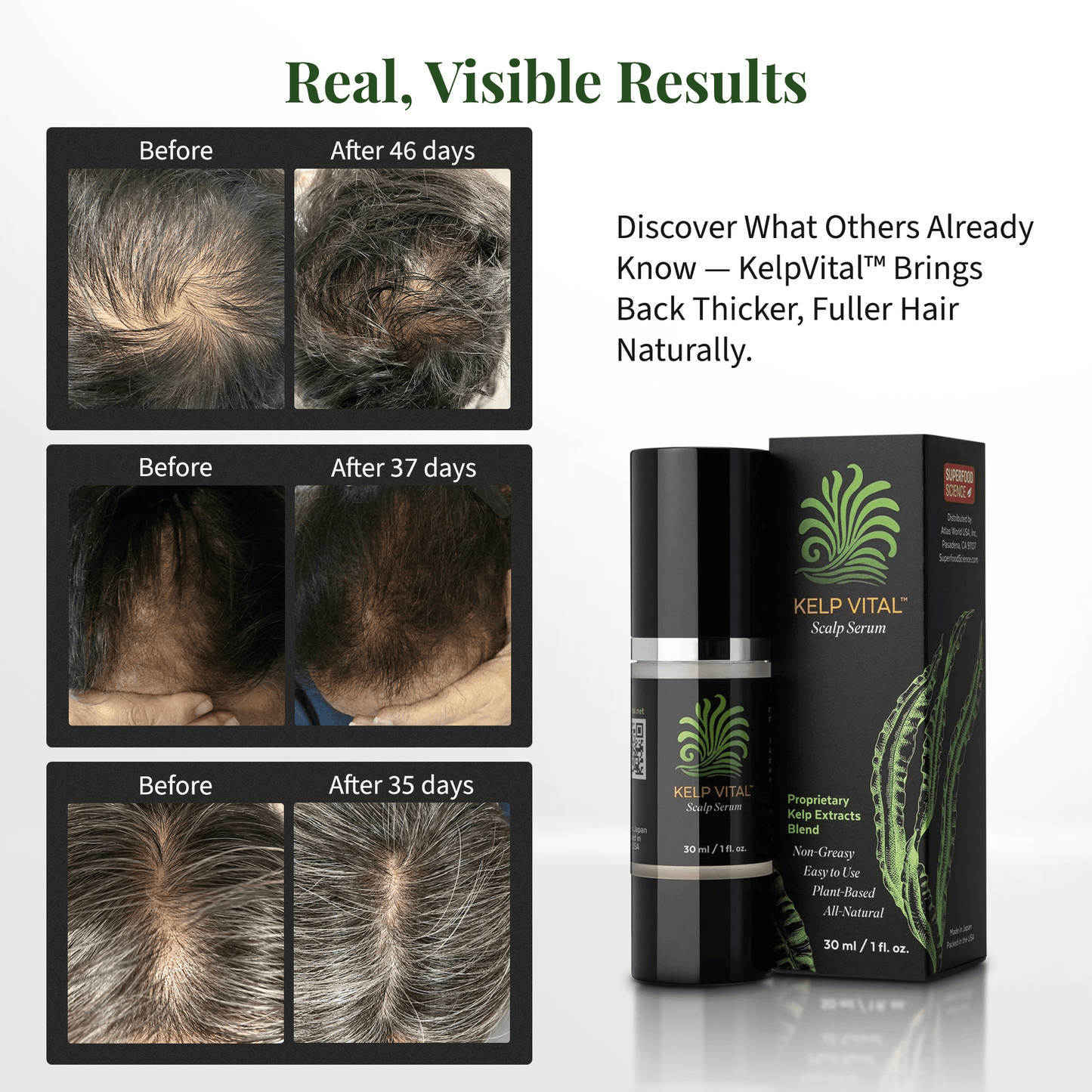 Kelp Vital Scalp Serum – Hair Growth Serum for Women & Men | Non-Greasy, Lightweight, Nourishing Formula for Thinning Hair