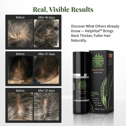 Kelp Vital Scalp Serum – Hair Growth Serum for Women & Men | Non-Greasy, Lightweight, Nourishing Formula for Thinning Hair